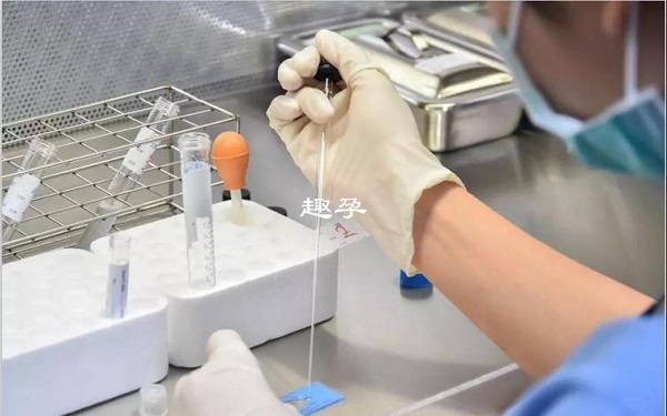 HIV洗精方法