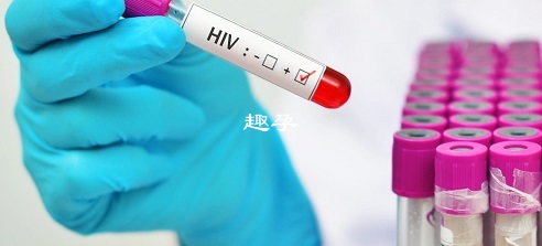 HIV