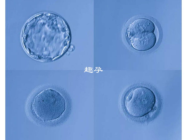 卵巢監測報告單會詳細記錄卵泡情況