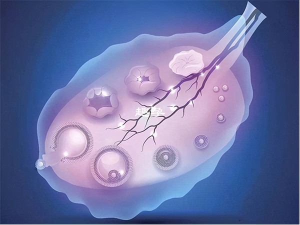 多囊卵巢患者主要是通過調經促排