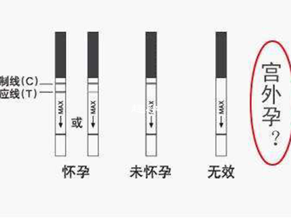 通常建議女性用晨尿做樣本檢測