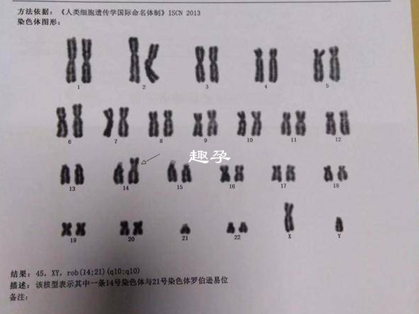 易位后个体遗传物质的缺失影响个体的发育