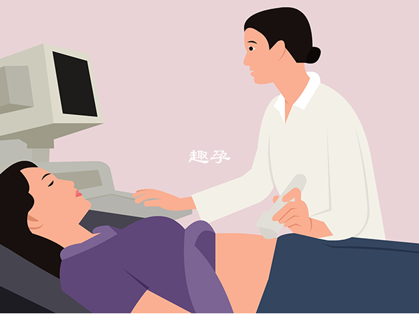 寶媽們要隨時開展胎心監測