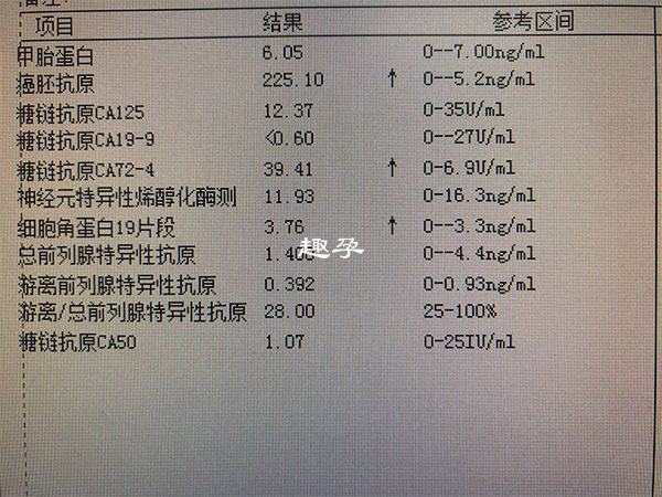 甲胎蛋白檢查結果單