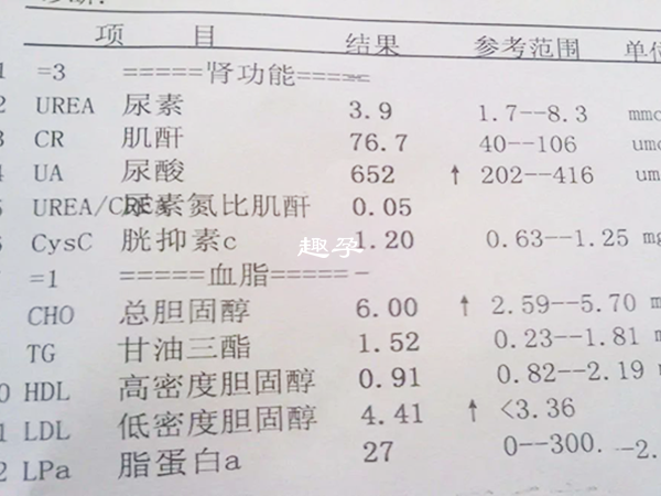 肾功能检查结果中血肌酐、尿素氮和尿酸是关键