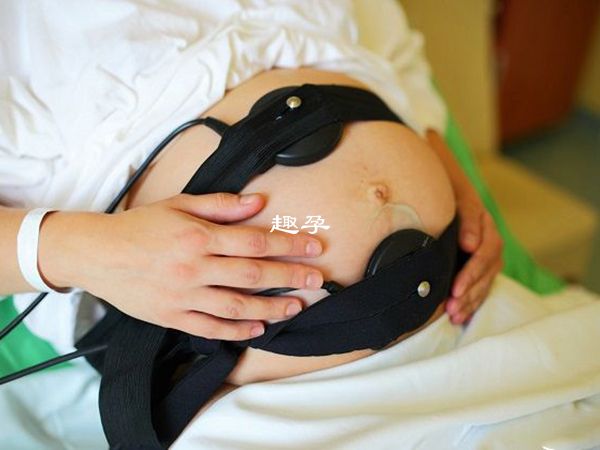 胎心150次一分钟以上的大多是女孩