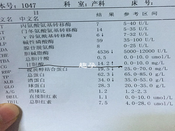 甘膽酸是一項重要的孕期檢查專案