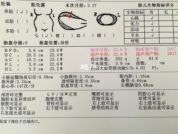 大小小排畸檢查專案相似