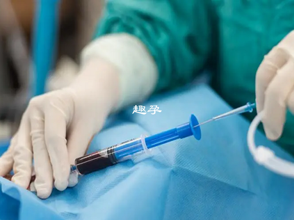 懷孕後需要做羊水穿刺