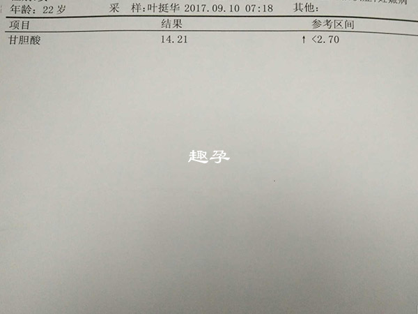 孕婦甘膽酸用於評估身體健康