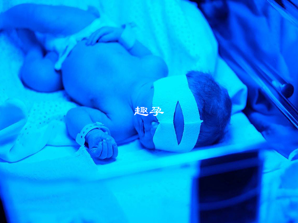 藍光可以治療黃疸