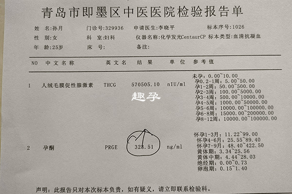 女性体内hcg激素检验报告单