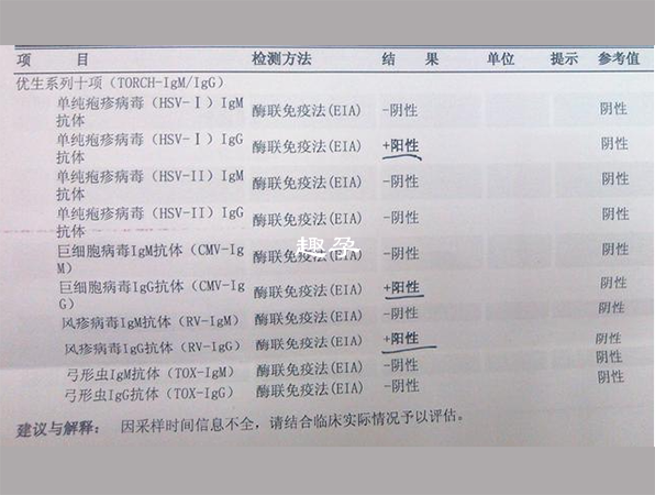 如果確診體內有病毒感染說明正在感染期