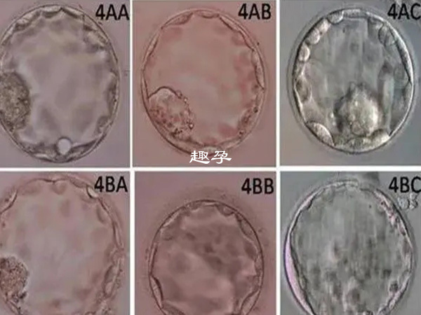 1级和2级囊胚属于优质胚胎