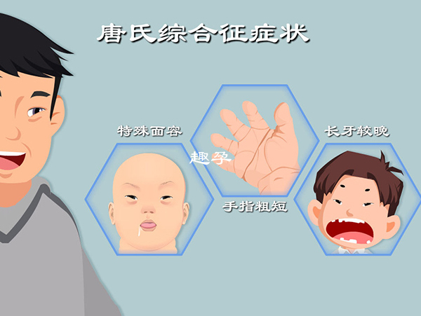 高龄孕妇生出畸形儿的几率也非常高