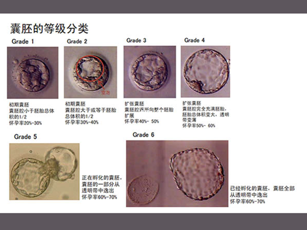 胚胎的等級越高則質量越好