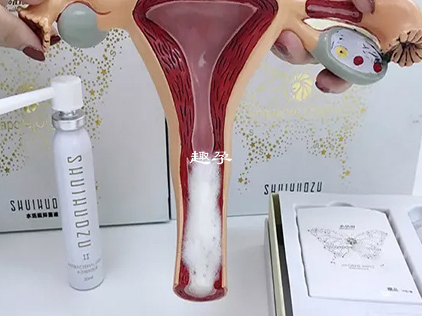 女性做取卵手術後有患卵巢過度刺激綜合徵的風險