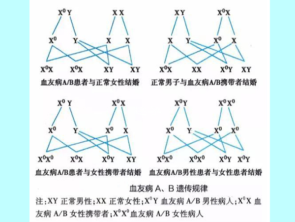 已经发现的X连锁隐性遗传病有200多种