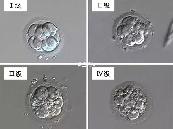 胚胎等级可以划分为四个等级