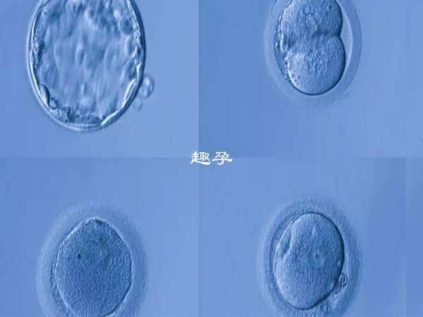 患者最好不要盲目養囊