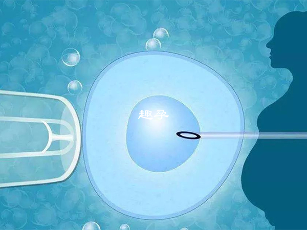國內供精試管成功率在30-60%左右不等