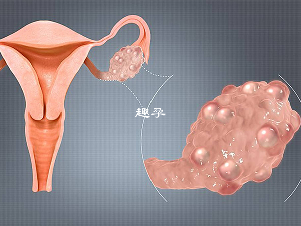 降調主要是為了防止女性早排卵