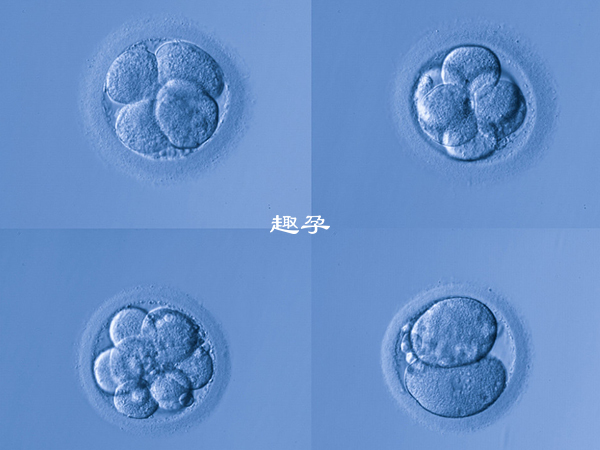 胚胎級別是衡量胚胎質量的一個標準