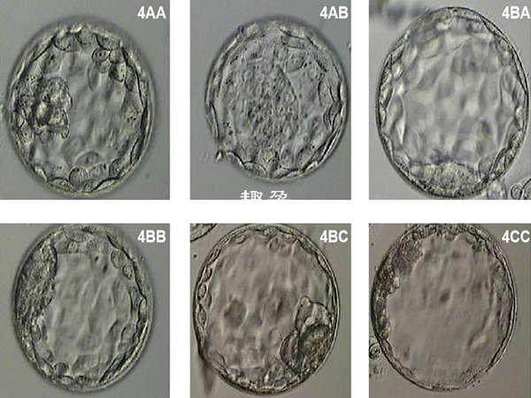 4bb和4bc囊胚