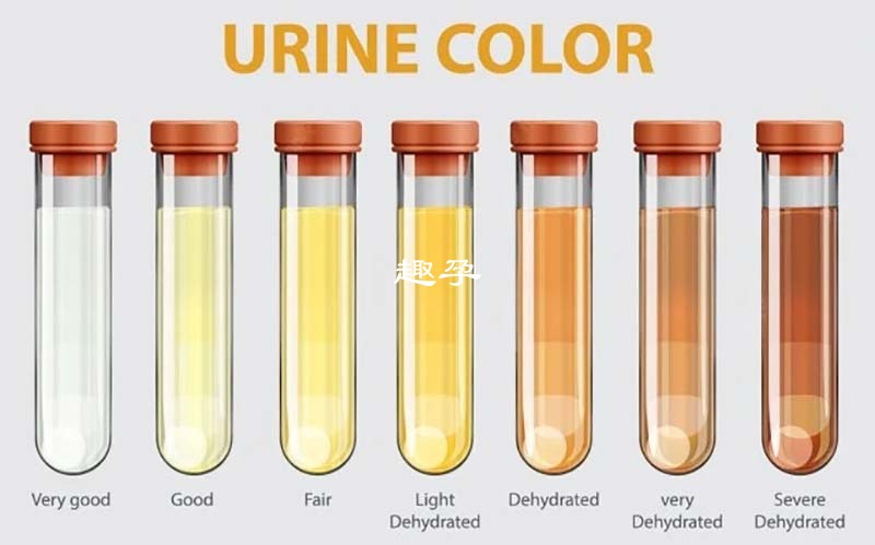 不同尿液颜色代表疾病