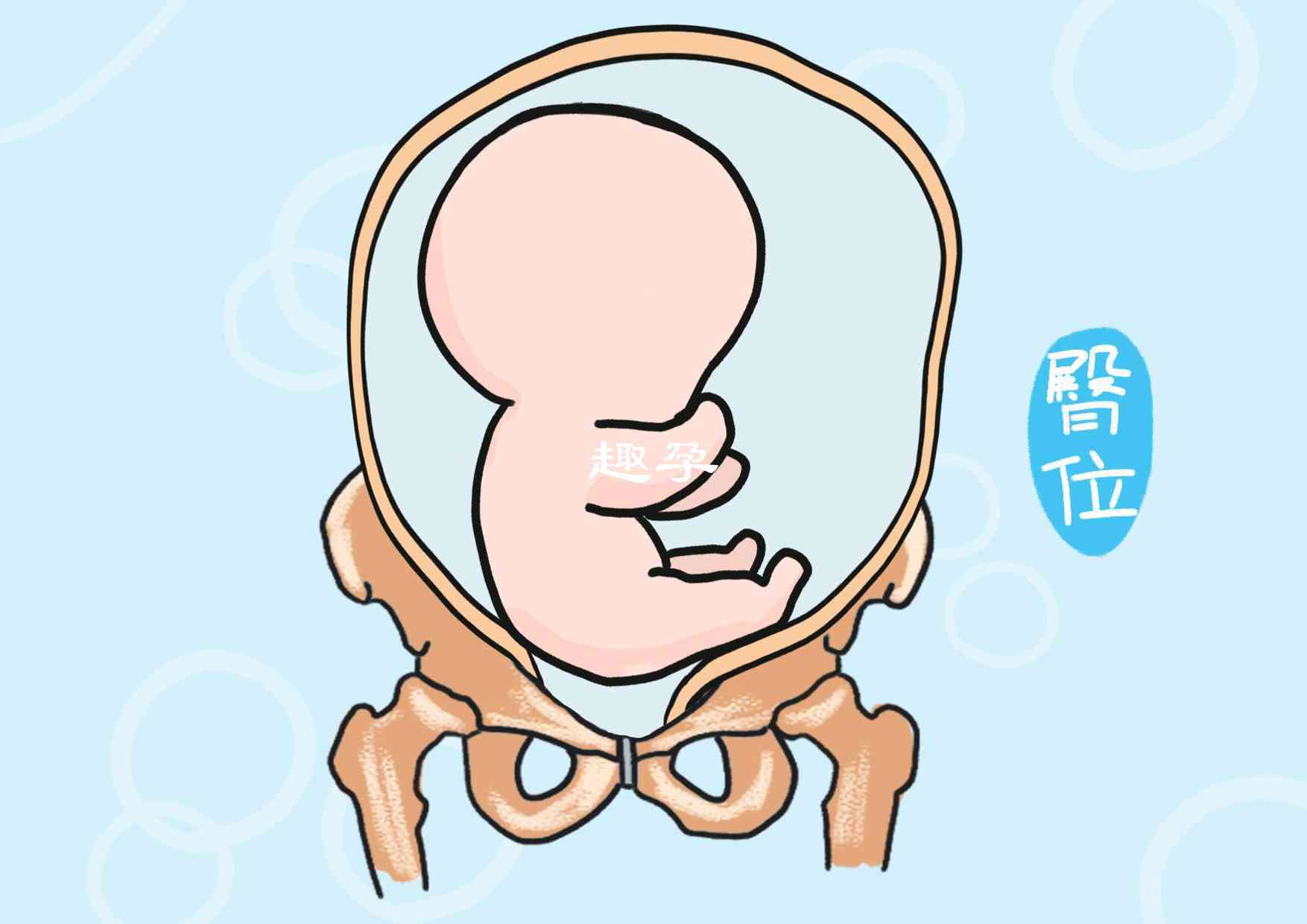 roa胎位姿势是不是生男孩，正确解读胎位姿势的意义
