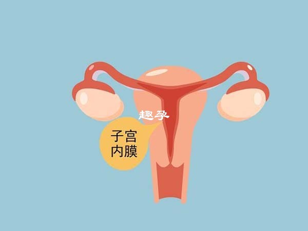 巧克力囊腫由子宮內膜異位造成