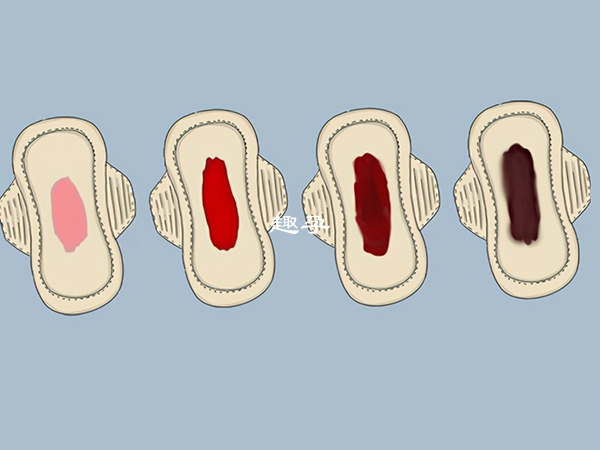 着床出血分为三种颜色