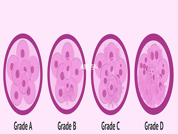 胚胎等級會影響試管嬰兒的成功率