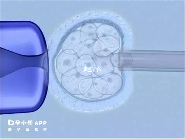 北医三院试管婴儿医生临床经验丰富