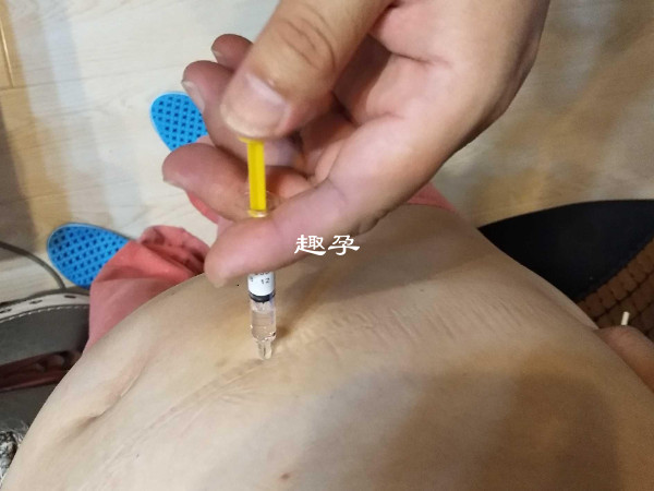 打完達必佳後卵泡還會繼續生長