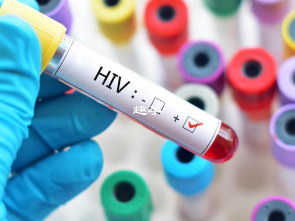 男性感染hiv可通過洗精術生育寶寶