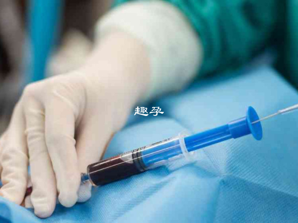 羊水穿刺和無創DNA有區別