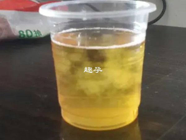 碘酒测怀孕小方法