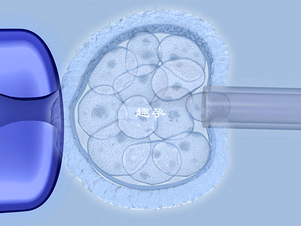 试管婴儿取卵