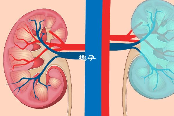 腎積水嚴不嚴重的危害一覽