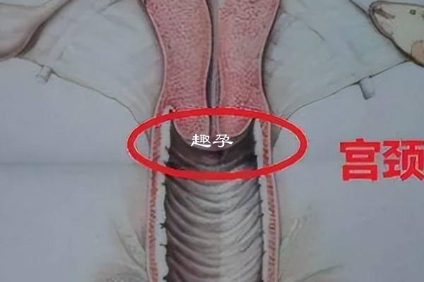 子宮千位後悔會不會發生變化解析