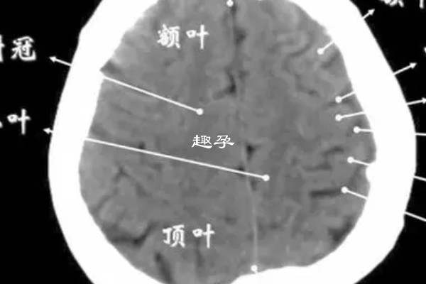 引起內分泌異常的五種疾病一覽