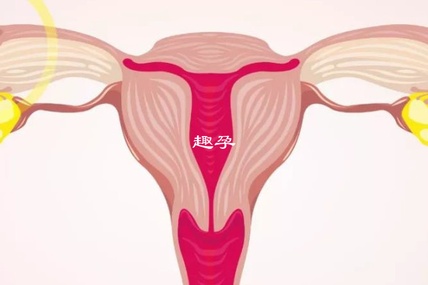 输卵管切除患者能否做试管助孕解析