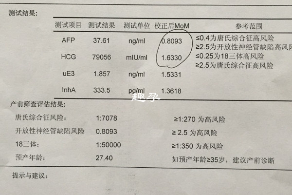 無創dna檢查單不能看男女