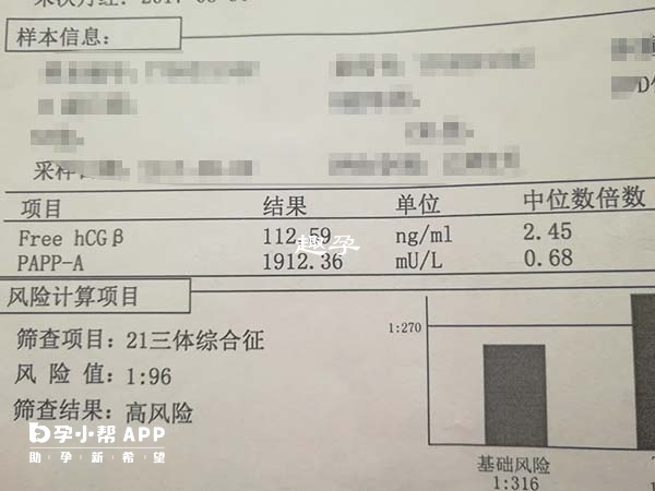 高龄产妇21三体易高危