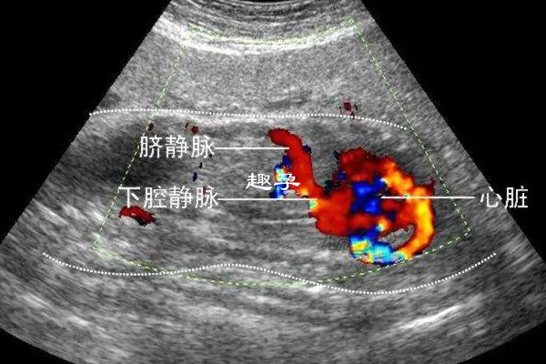 孕晚期的大检查主要包括B超等常规检查