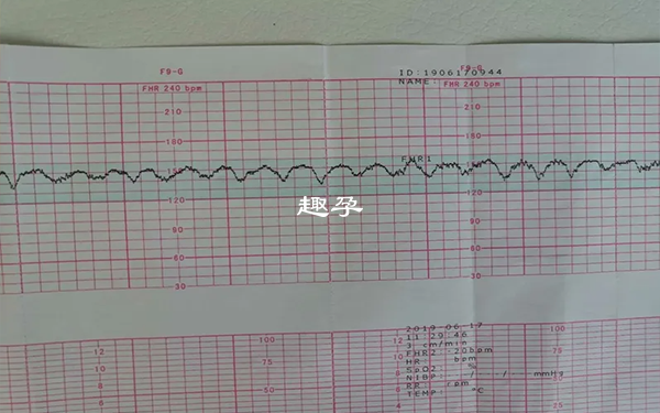 胎心監護不能看男女