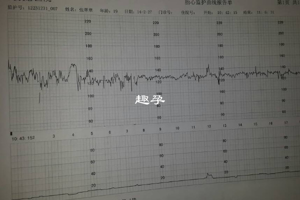 大半夜宫缩不可以早上去医院