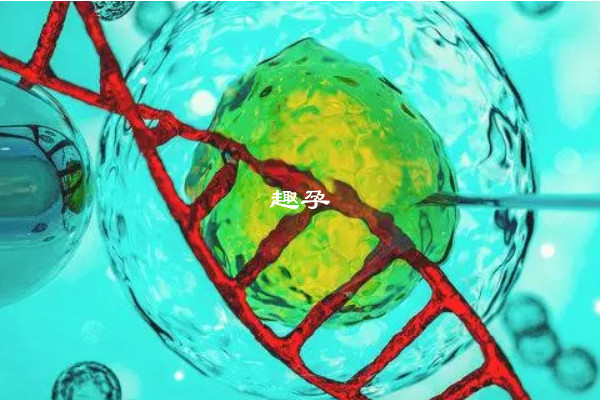 火棉膠嬰兒與多種基因異常有關